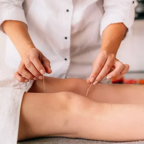 Acupuntura y Fitoterapia